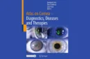 Atlas on Cornea: Das neue Standardwerk der Hornhaut setzt Maßstäbe in Diagnostik & Therapie