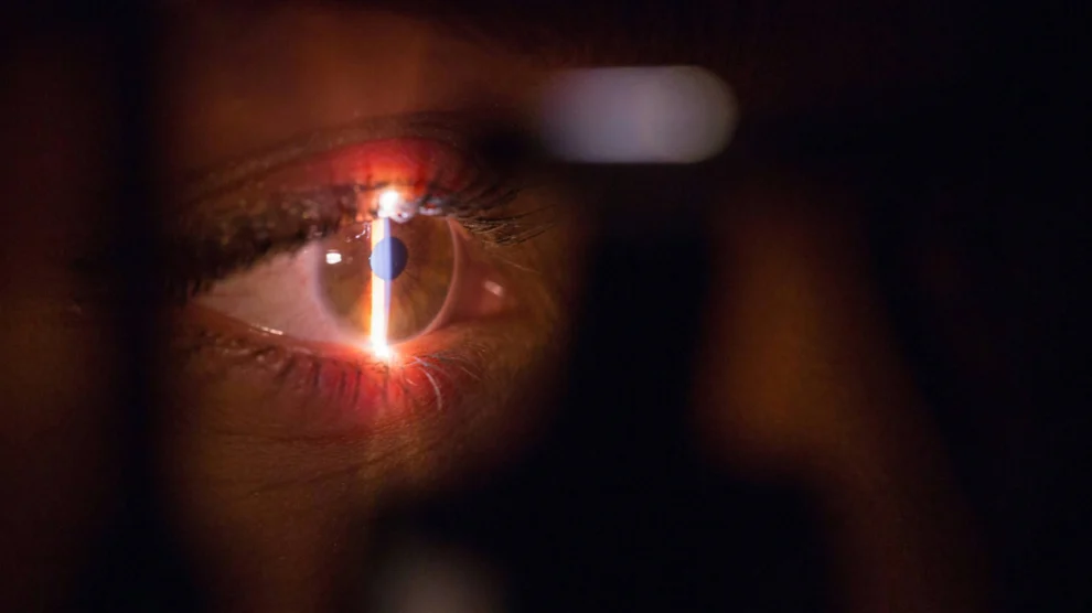 Netzhautveränderungen liefern Hinweise auf genetisches Schizophrenie-Risiko