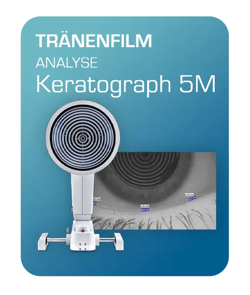 Oculus Tränenfilm Analyse