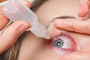 Trockene Augen als mögliches Frühzeichen von Autoimmunerkrankungen