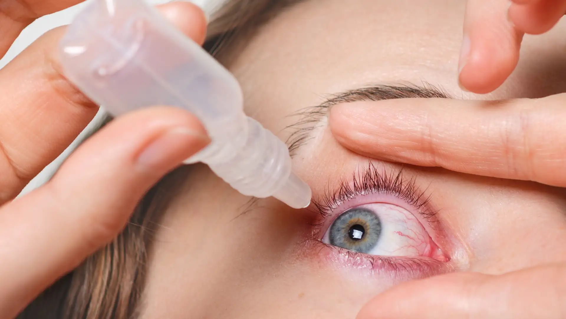 Trockene Augen als mögliches Frühzeichen von Autoimmunerkrankungen